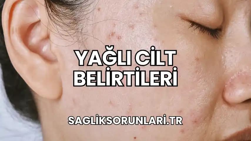 Yağlı Cilt Belirtileri ve Uygun Bakım Yöntemleri Hakkında Kapsamlı Rehber