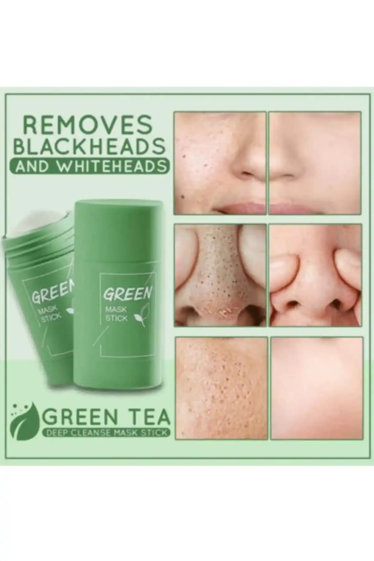AcarlarTicaret Yeşil Çay Özlü Siyah Nokta ve Sivilce Maskesi Hakkında Detaylı Bilgi
