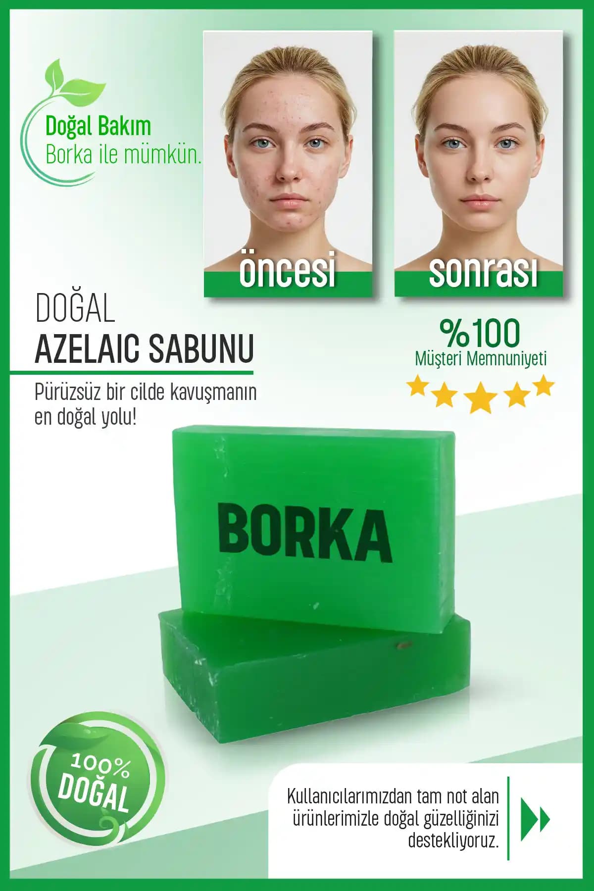 BORKA Azelaic Yüz Temizleme Barı: Leke Karşıtı ve Gözenek Sıkılaştırıcı Cilt Bakım Ürünü