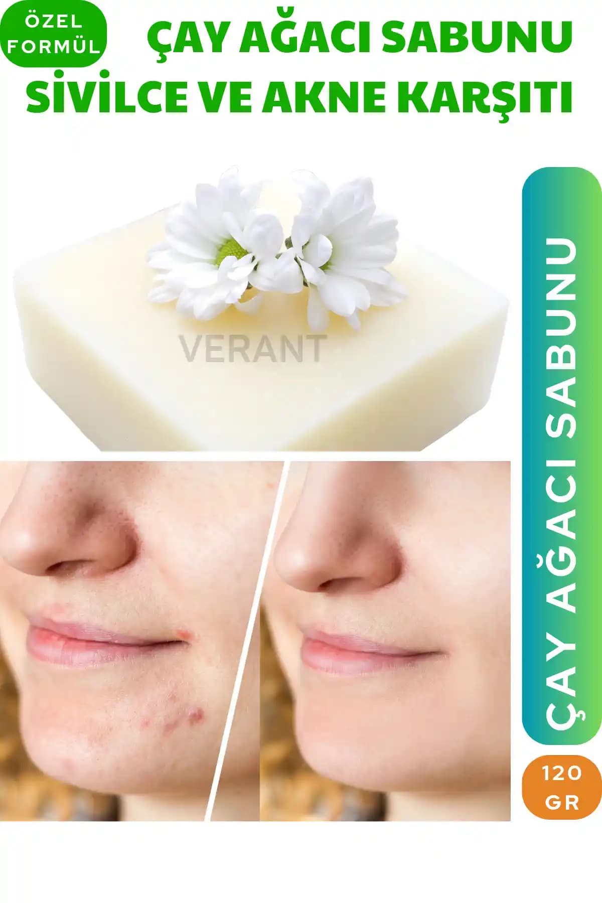 VERANT Çay Ağacı Sabunu: Doğal ve Etkili Cilt Temizliği için Güvenilir Çözüm