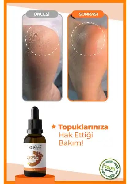 Wyess Doğal İçerikli Ayak ve Topuk Bakım Yağı: Kuru ve Çatlak Ayaklar İçin Etkili Çözüm