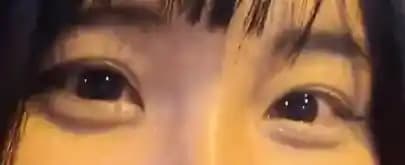 Aegyo-Sal Nedir? Doğal Görünüm, Makyaj Teknikleri ve Dolgu Uygulamaları