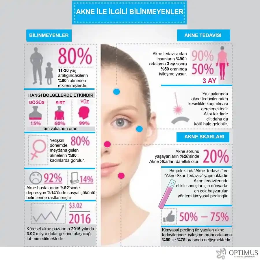 Akne Tedavisinde Zorluklar ve Alternatif Yaklaşımların Kapsamlı İncelenmesi