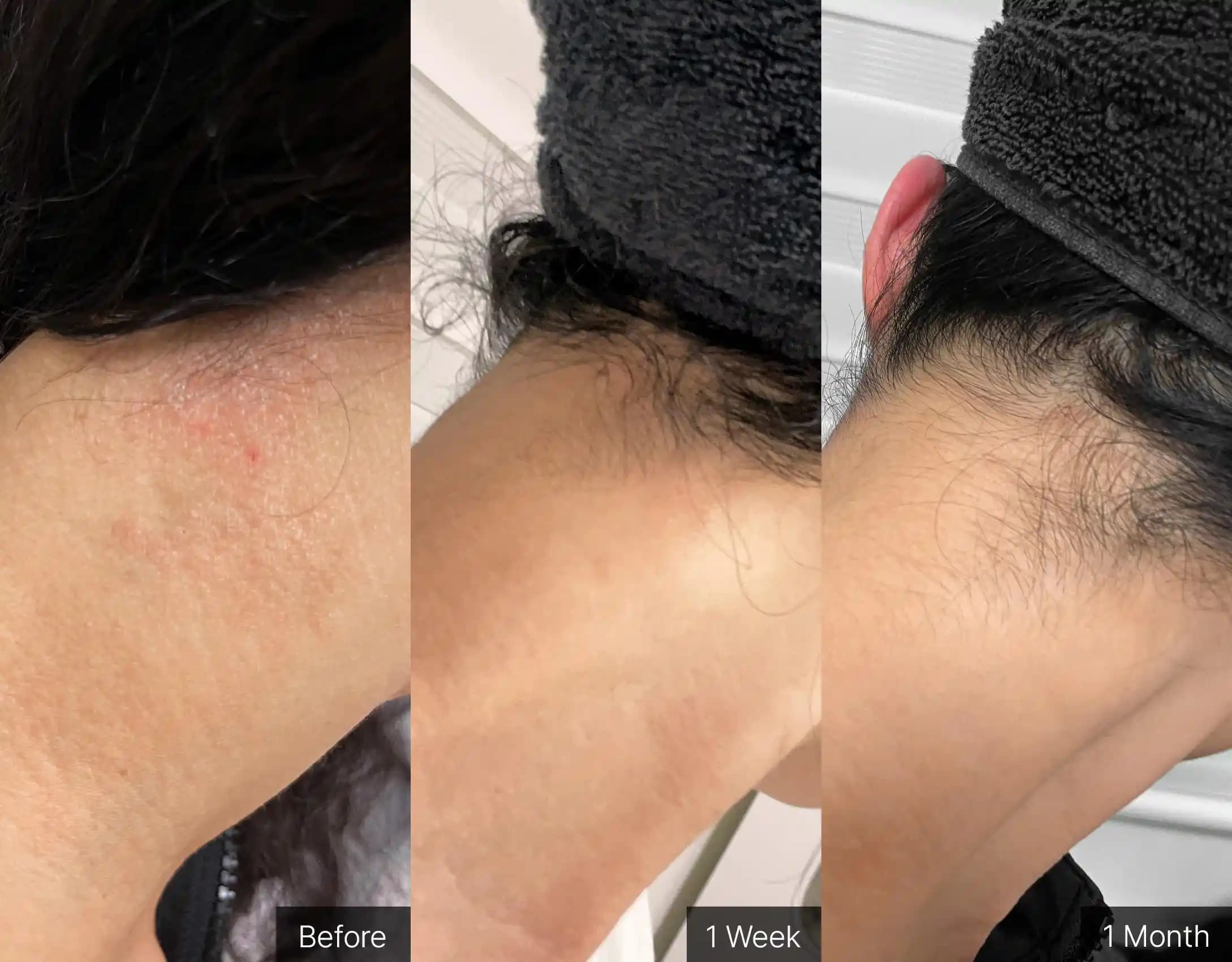 Illiyoon Ato Lotion: Hassas ve Kuru Ciltler İçin Etkili Vücut Nemlendiricisi