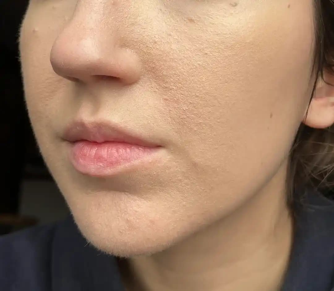 Kuru Ciltlerde Fondötenin Kabuklu Görünmesini Önlemenin Etkili Yöntemleri ve İpuçları