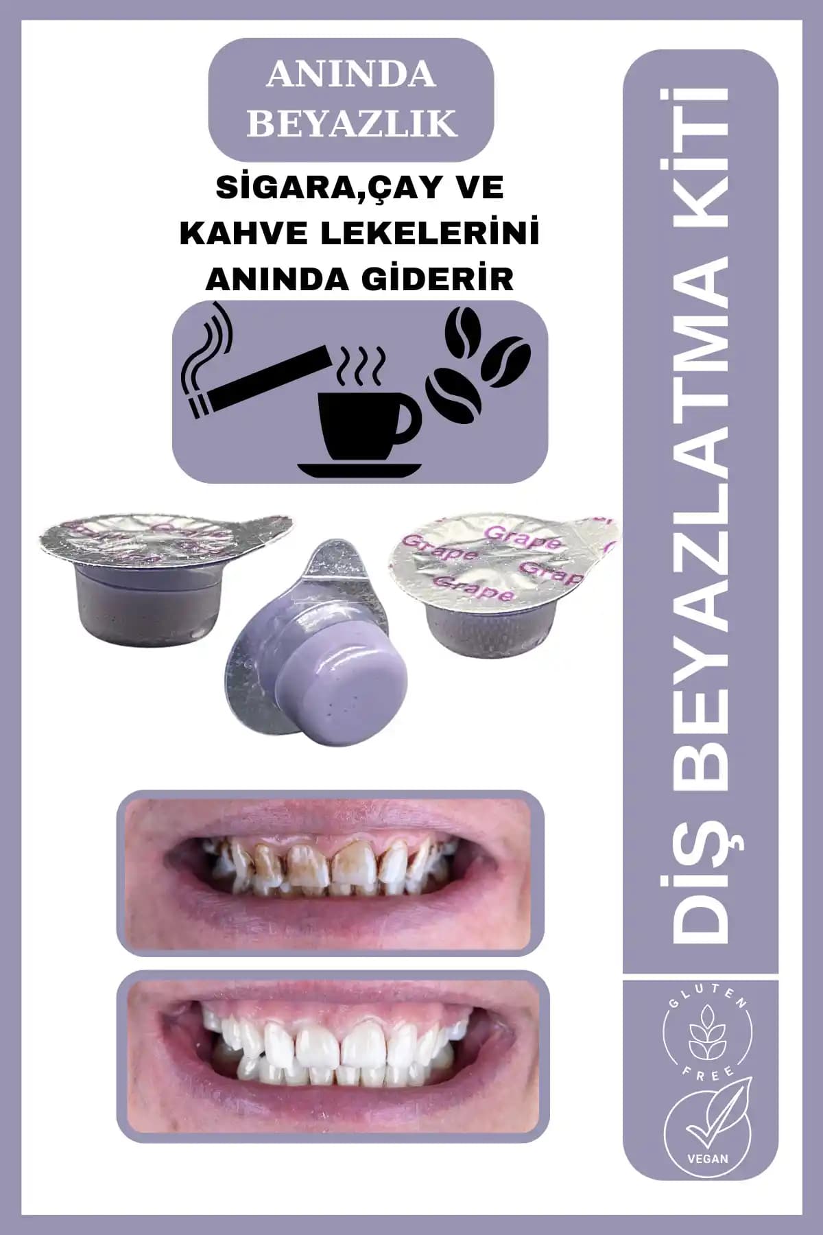 Avant Dental Supply 3 Tüplü Diş Beyazlatıcı Seti Analizi ve Kullanım Rehberi
