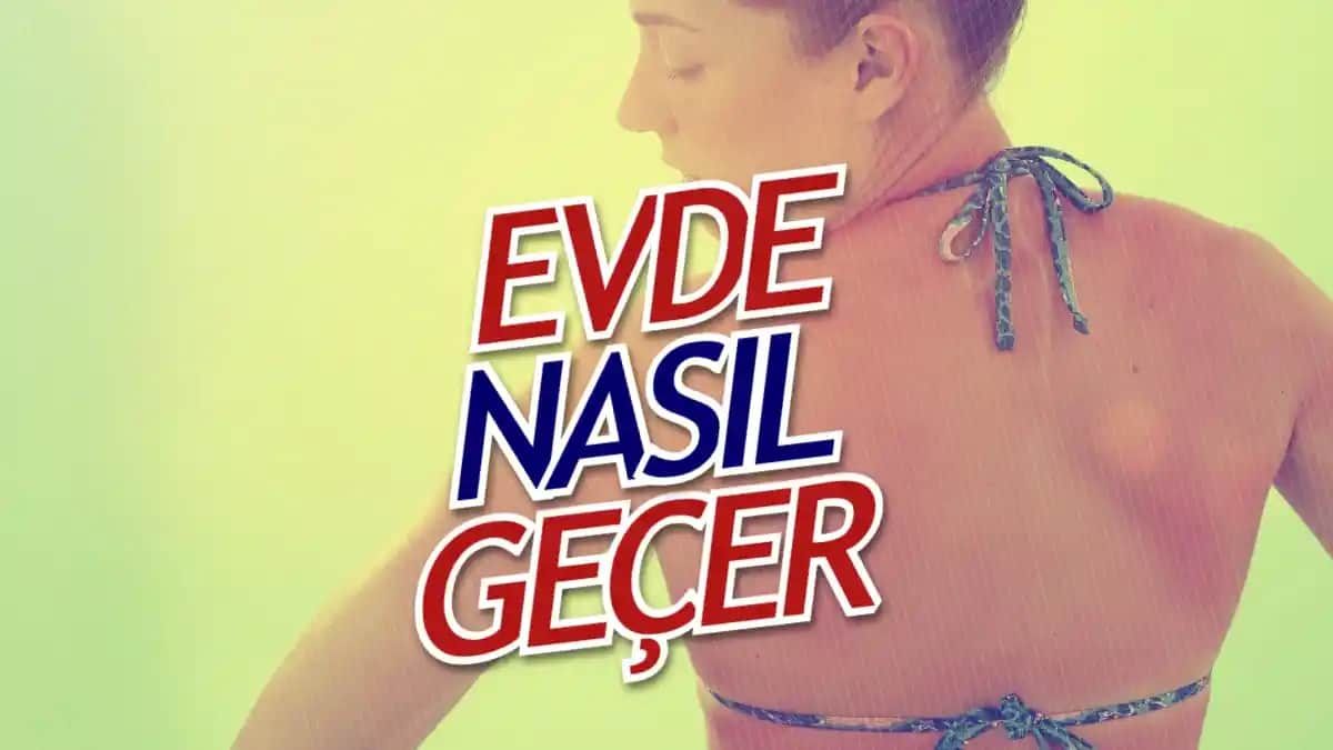 3. Derece Güneş Yanığı Nedenleri Belirtileri ve Etkili Tedavi Yöntemleri