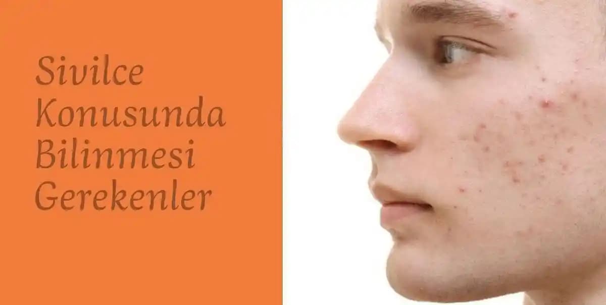 Çocukların Akneye Yönelik Tepkileri ve Bu Durumun Psikolojik Etkileri Üzerine İnceleme