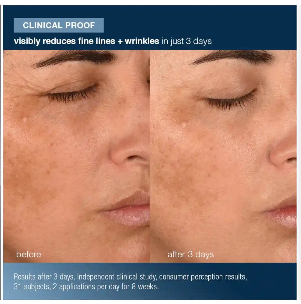 Dermalogica'nın Yeni Reklamında Fotoğraf Manipülasyonu ve Ürün Etkisi Tartışmaları