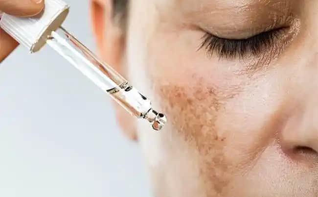 Cilt Bariyerinin Onarımı ve Sağlıklı Cilt İçin Uygun Bakım Yöntemleri