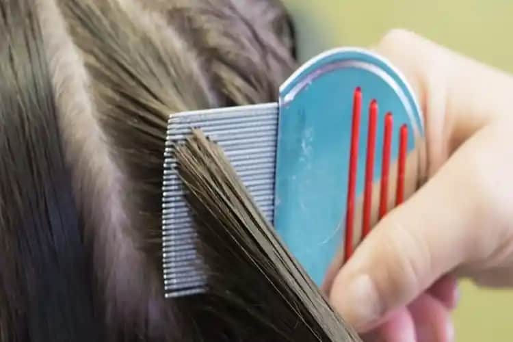 Eczanelerde Bit Tarağı Satış Durumu ve Kozmetik Mağazalarında Uygun Seçenekler