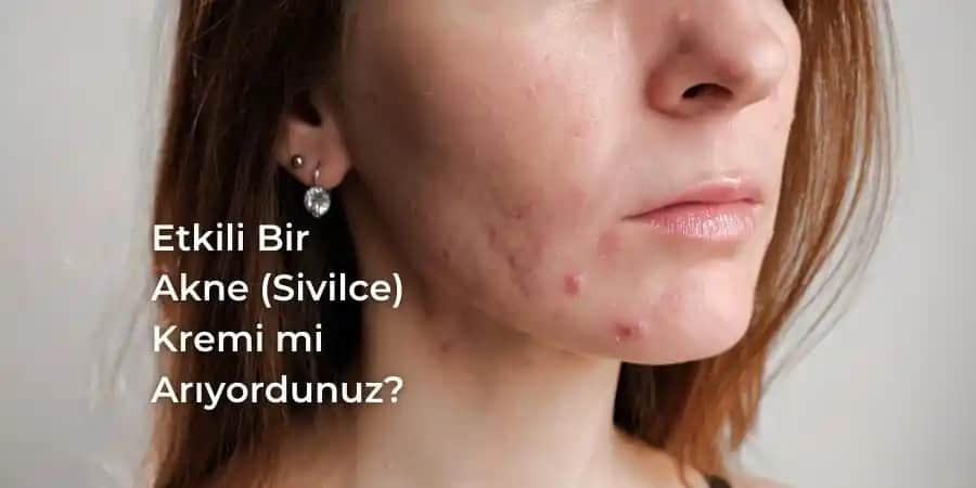 En Etkili Akne Kremleri ve Cilt Sağlığı İçin Doğru Seçim Rehberi