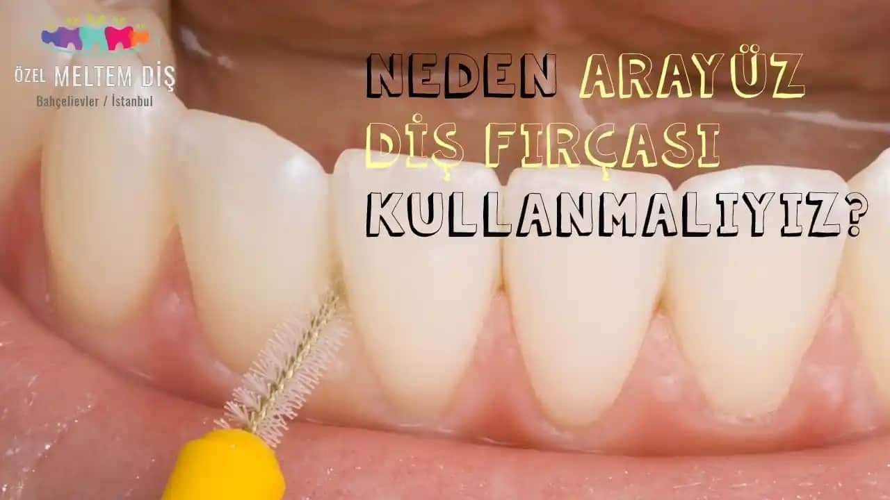 En İnce Arayüz Fırçası Seçimi ve Diş Sağlığında Önemi Hakkında Kapsamlı Bilgi