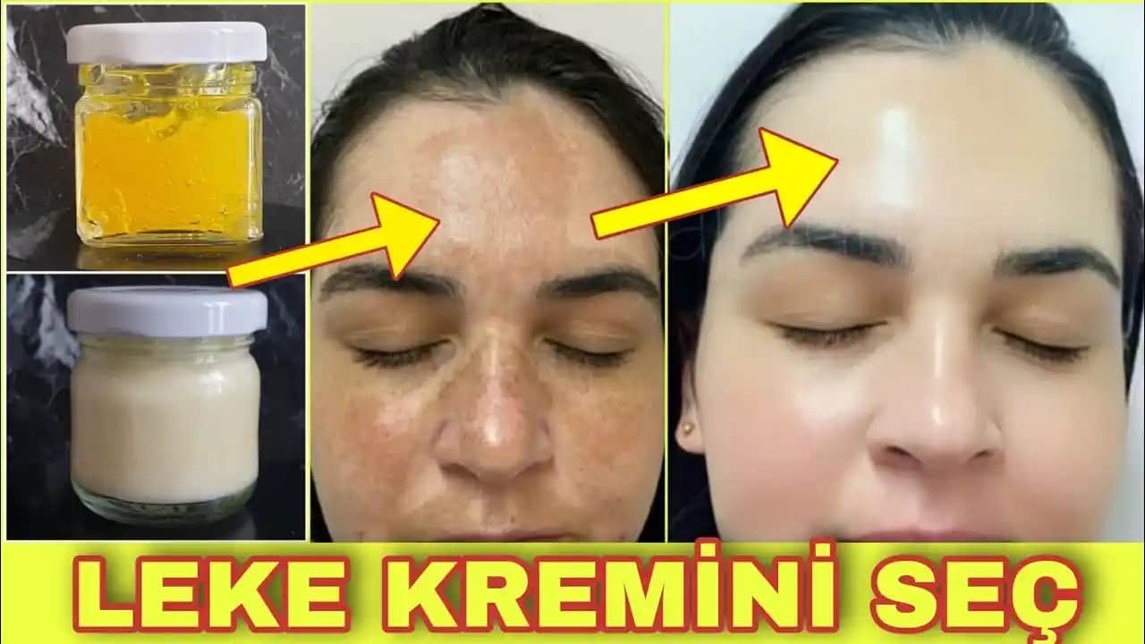 Güneş Lekeleri İçin En Etkili Kremler ve Bakım İpuçları Rehberi