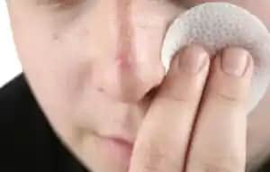 Kolonya ile Siyah Nokta Temizleme: Gerçekler ve Doğru Bakım Yolları