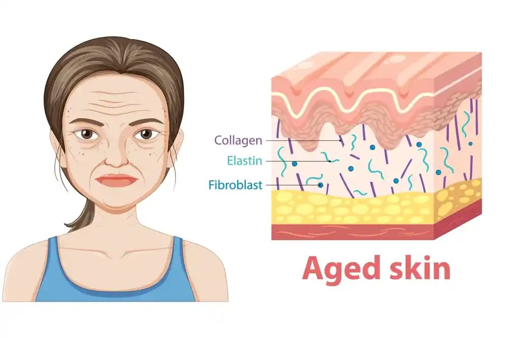 Yaşlanma Sürecinde Yüz Alt Bölgesinin Ağırlaşma Nedenleri ve Çözüm Yöntemleri