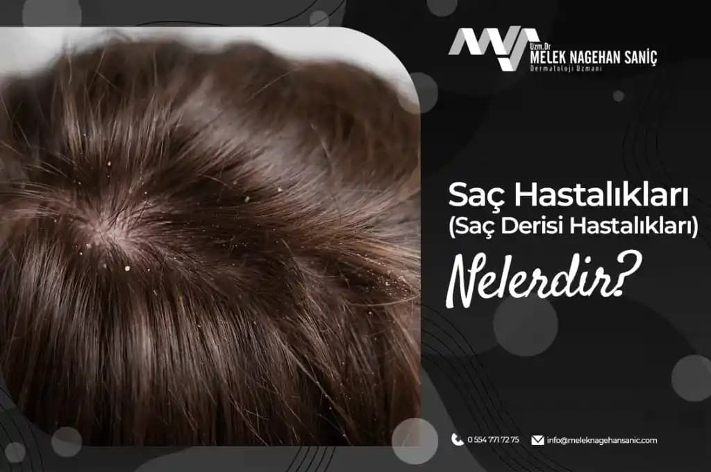 Aşırı Terlemenin Saç ve Saç Derisi Sağlığı Üzerindeki Etkileri ve Bakım Yöntemleri