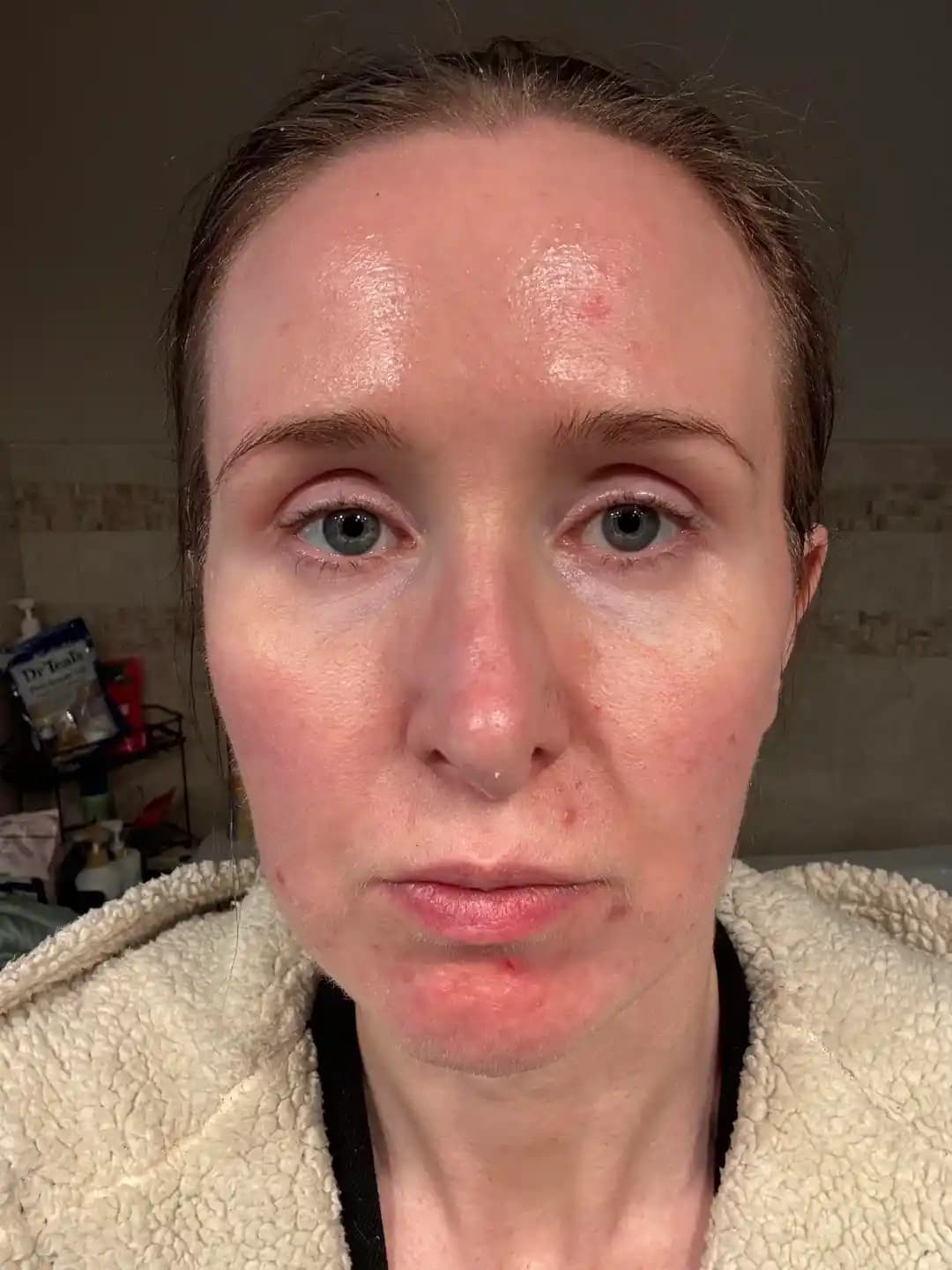 Cilt Bakımında Aktif Maddeler ve Bariyer Sağlığı: Yeni Başlayanlar İçin Kapsamlı Rehber