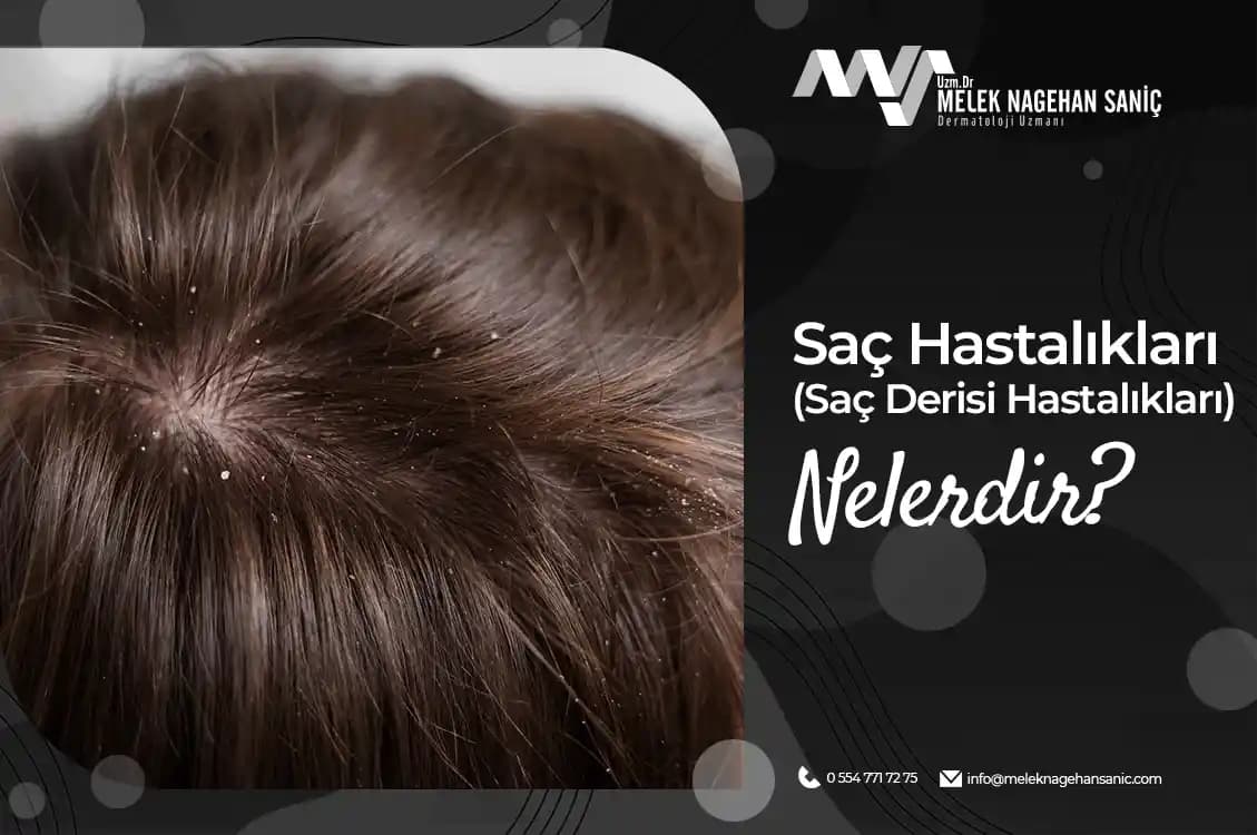 Saç Derisinde ve Köklerinde Oluşan Ağrının Nedenleri ve Çözüm Yolları