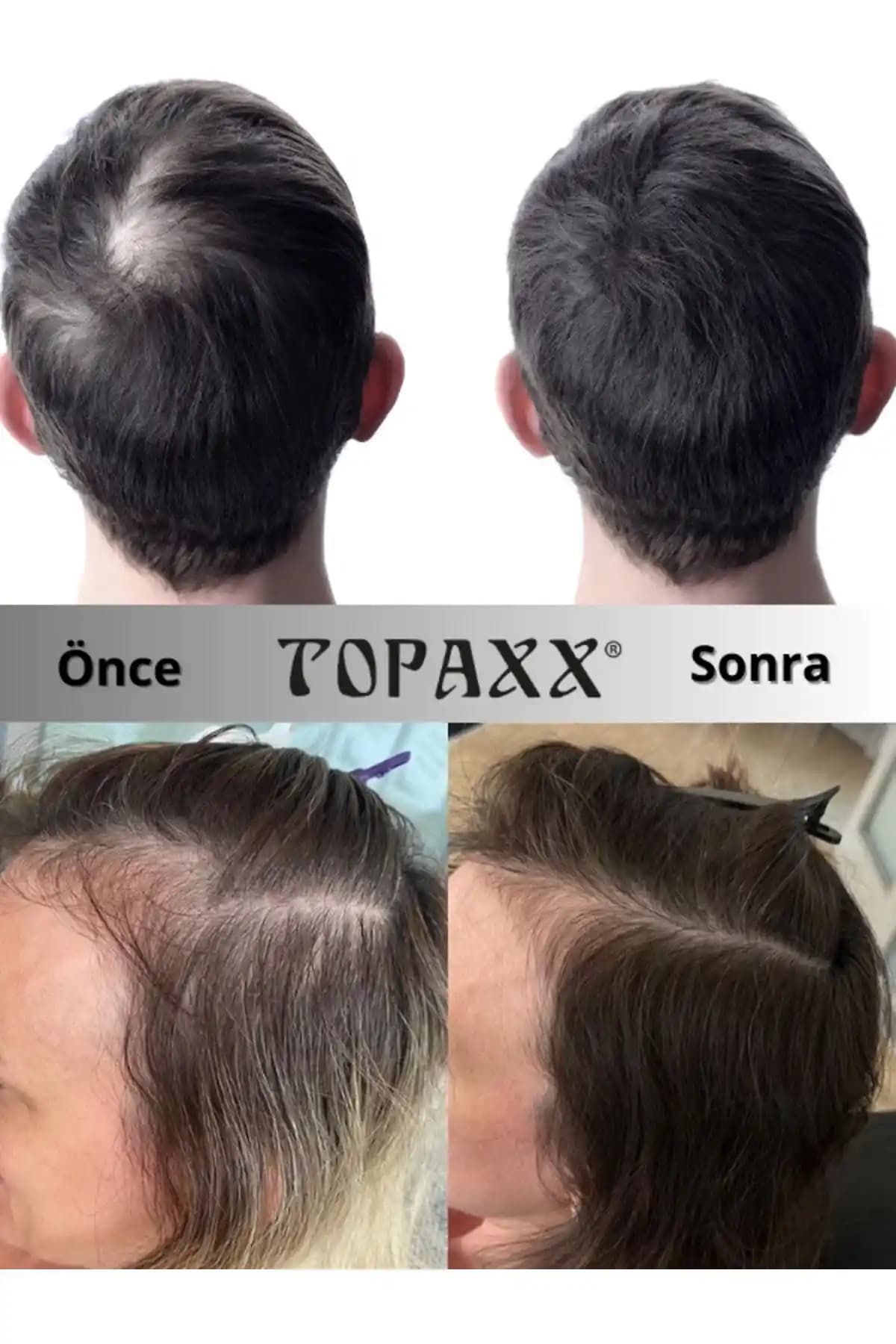 Saç Dolgunlaştırıcı Boyalar ve Kullanım İpuçları: Doğal Görünüm İçin En İyi Çözümler