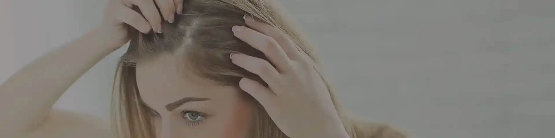 Şampuan Değiştirmek Kepek Yapar mı Saç Sağlığı ve Doğru Bakım İpuçları