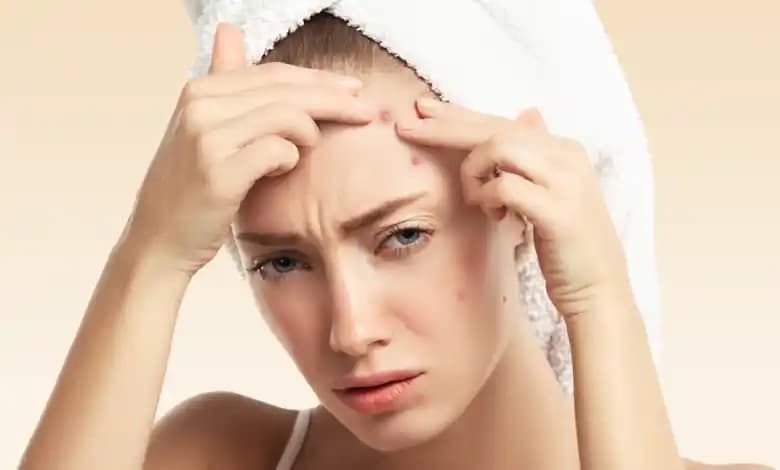 Sebum Üretimini Azaltma Yöntemleri ve Cilt Sağlığına Etkileri Kozmetik Perspektiften