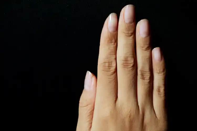 Tırnak İncelmesi Nedenleri Belirtileri ve Etkili Çözüm Yolları Hakkında Kapsamlı Bilgi