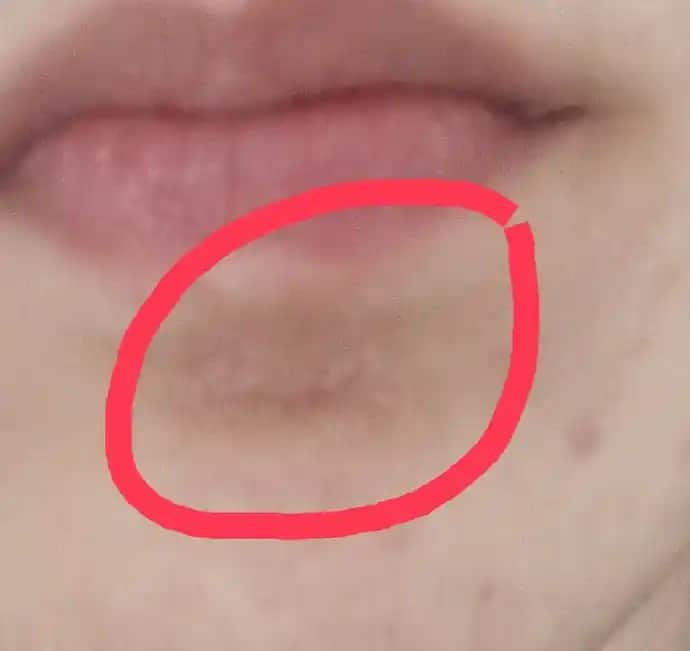 Yüzde Pul Pul Dökülme Nedenleri ve Etkili Çözüm Yolları Hakkında Bilgiler