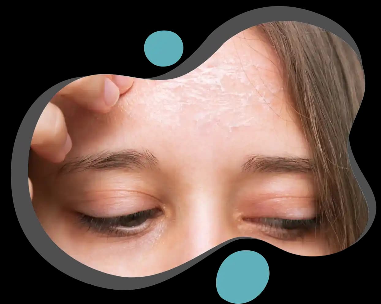 Yüzdeki Pullanma Nedenleri ve Etkili Çözüm Yolları Hakkında Kapsamlı Rehber