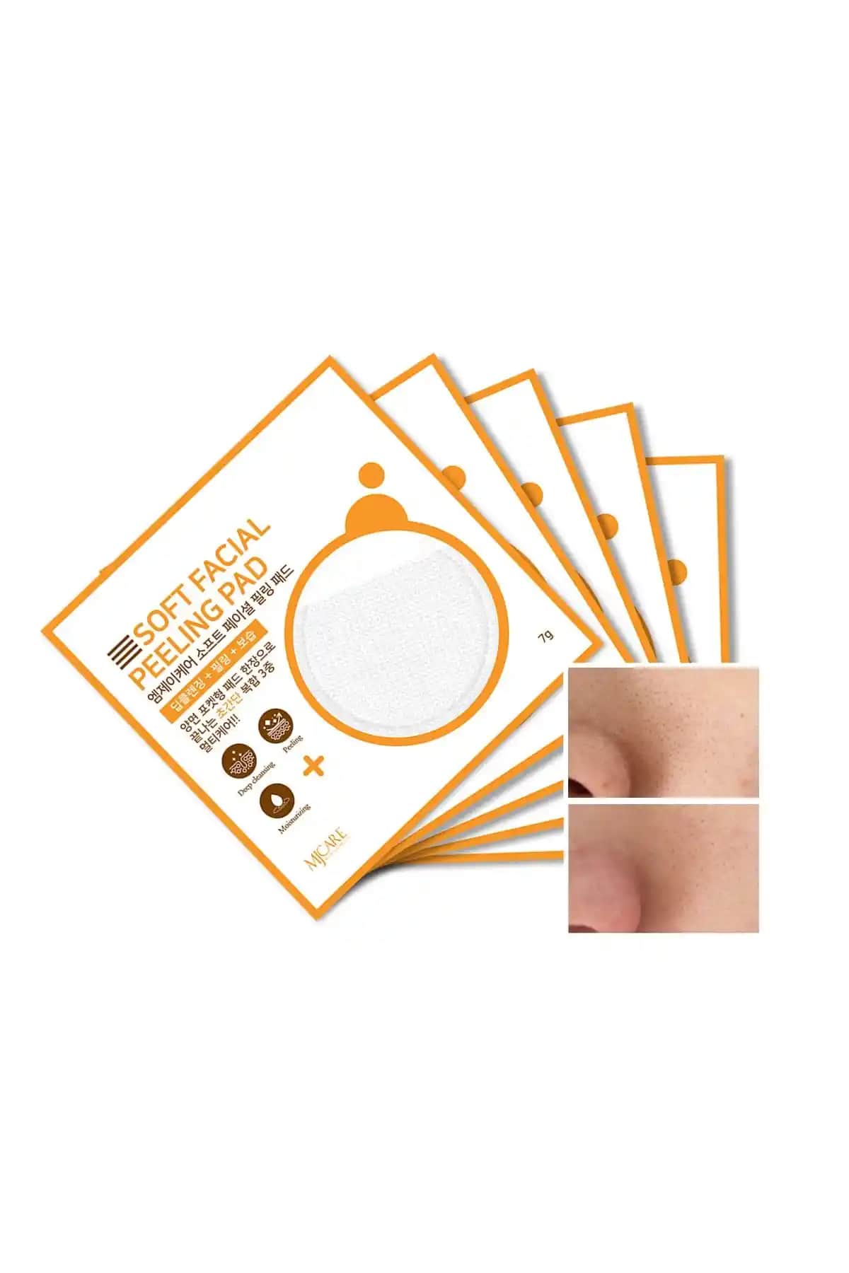 Mjcare Face Peeling 5'li: Hassas ve Karma Ciltler İçin Derin Temizlik ve Yumuşatma Ürünü