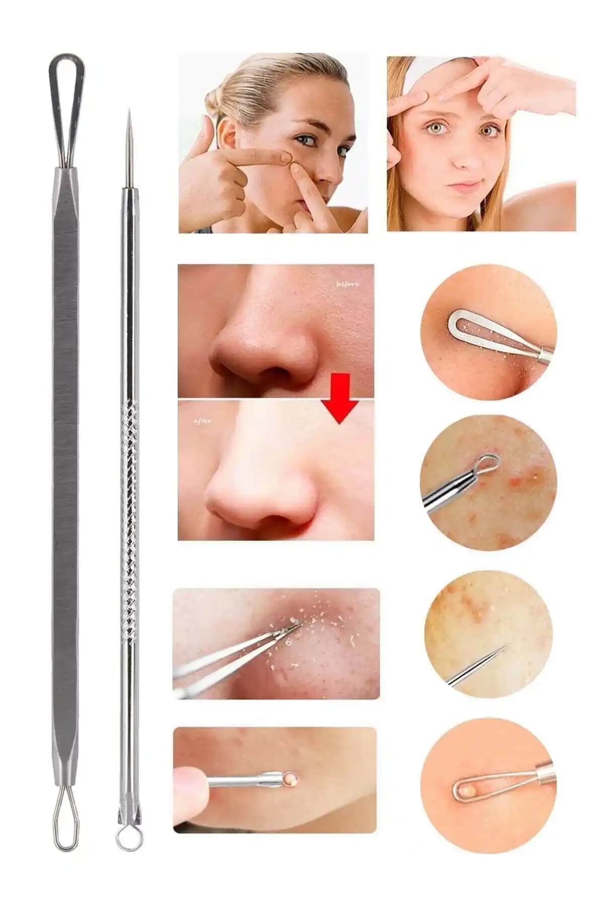 Ocean Akne ve Siyah Nokta Temizleyici Komedon: Etkili ve Pratik Cilt Bakım Çözümü