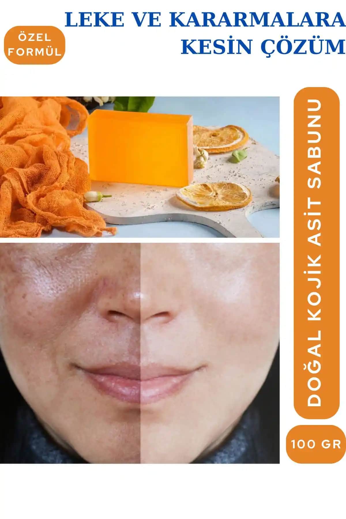 Verant Kojik Asit Sabunu: Leke Azaltıcı ve Cilt Aydınlatıcı Doğal Sabun