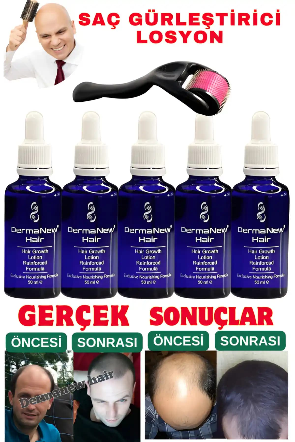 Dermanew Hair Saç Losyonu: Güçlü ve Sağlıklı Saçlar İçin Etkili Bir Çözüm