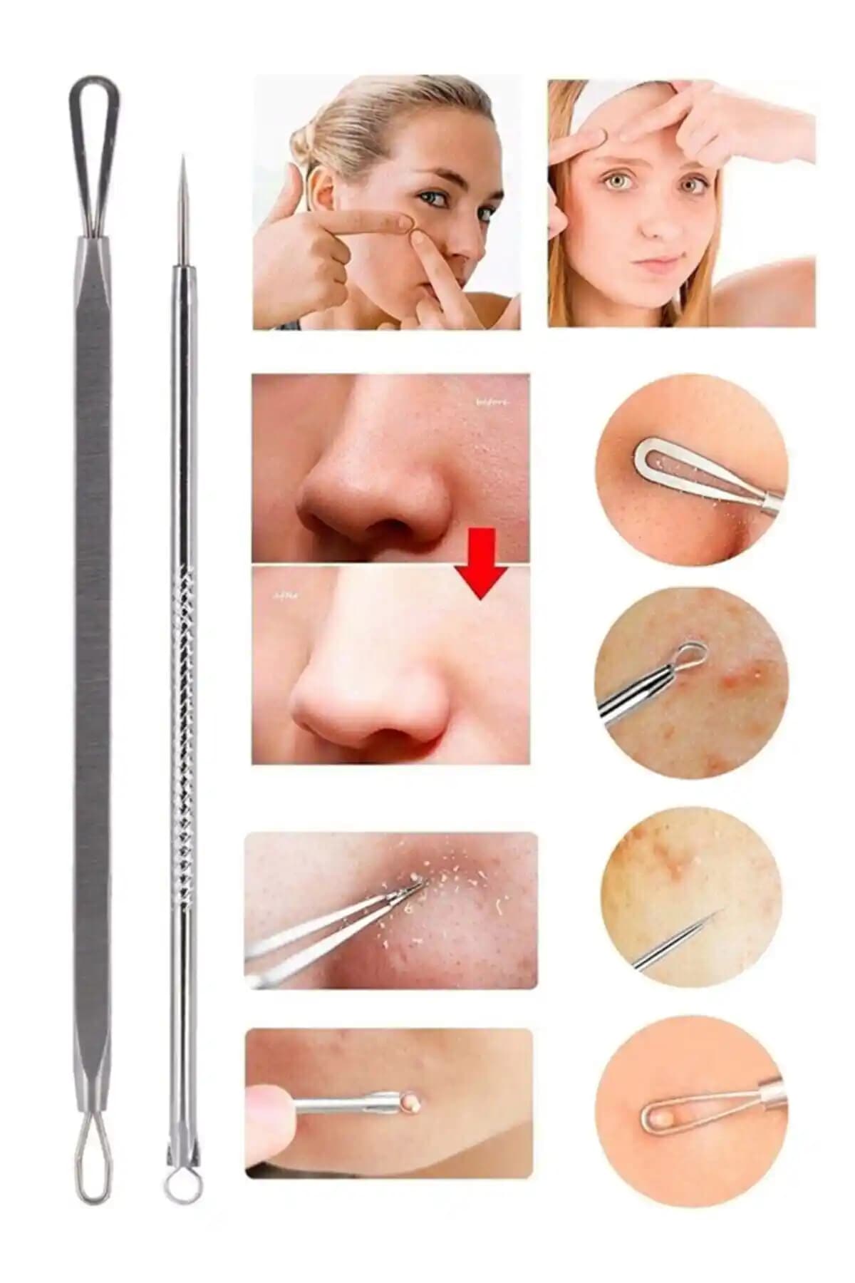 Genel Markalar 2'li Akne ve Siyah Nokta Temizleyici Çelik Seti Ürün Özellikleri ve Kullanım İpuçları