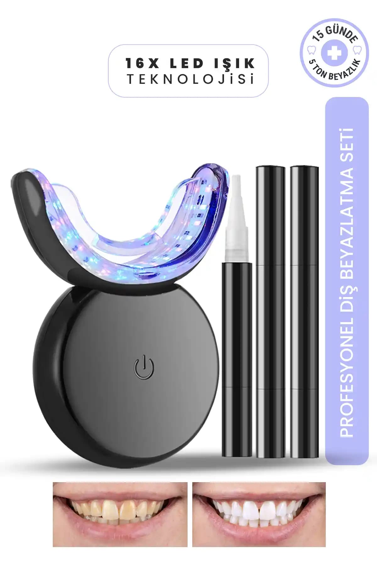 MOEN Profesyonel Diş Beyazlatma Seti 16 LED ile Güvenli ve Etkili Sonuçlar