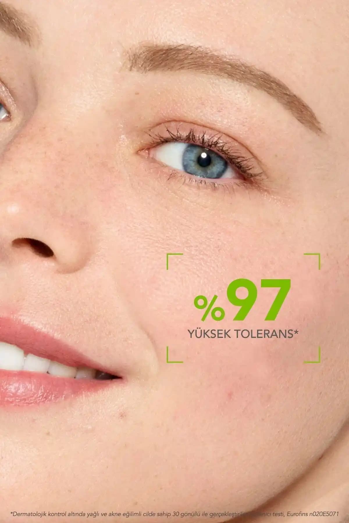 Akne Eğilimli Ciltler İçin Etkili ve Güvenli Bakım Rehberi