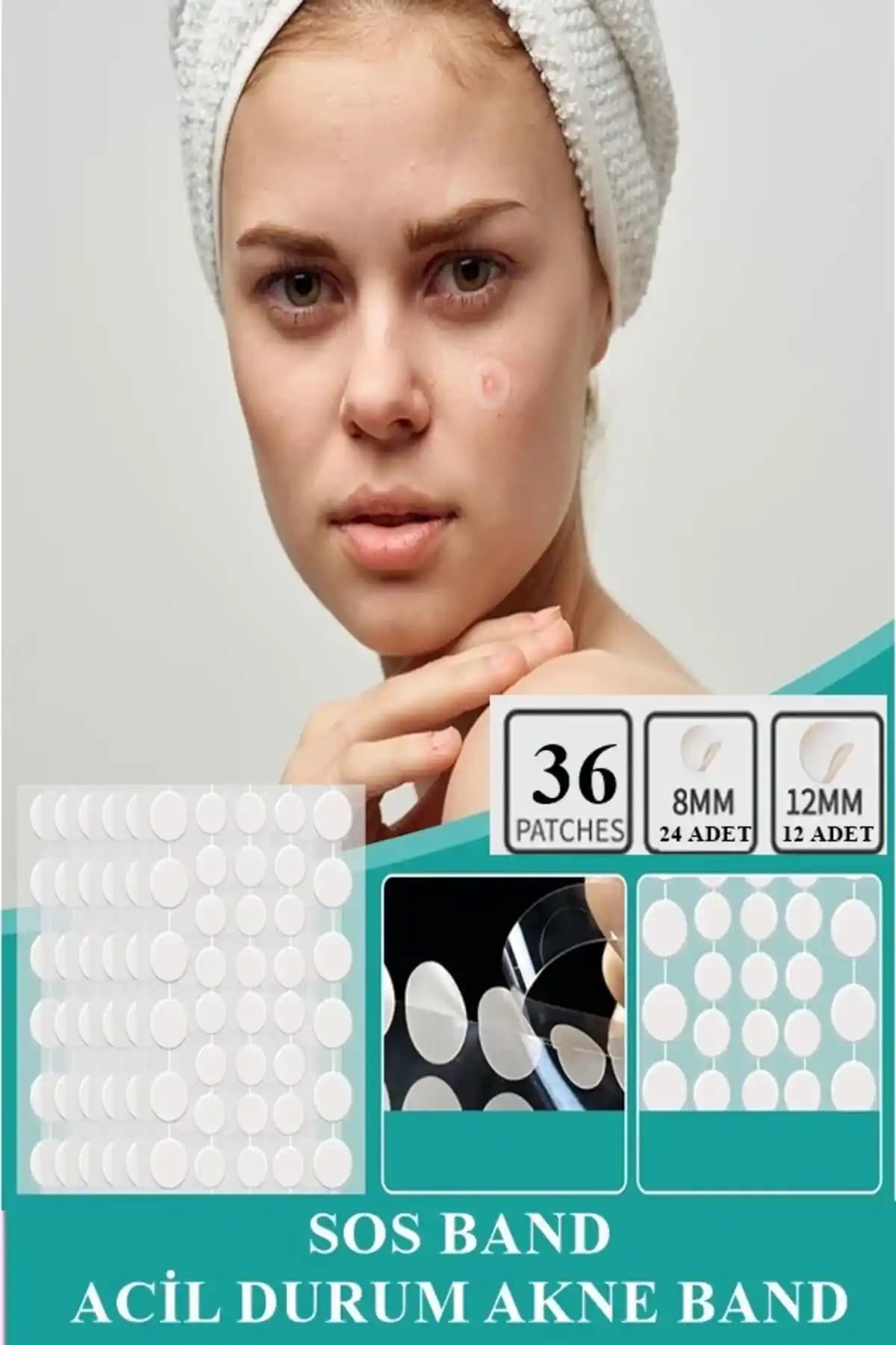 Akne Tedavisinde Dahaus ve Seul Bantların Karşılaştırması ve Kullanım Alanları