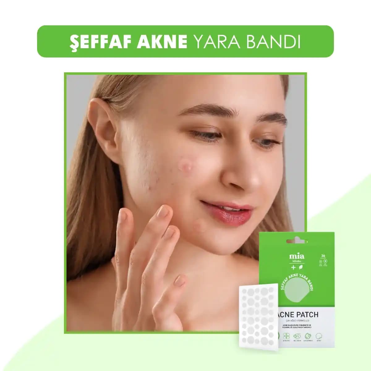 Akne Tedavisinde Sivilce Bantları: Farklı Markalar ve Kullanım İpuçları