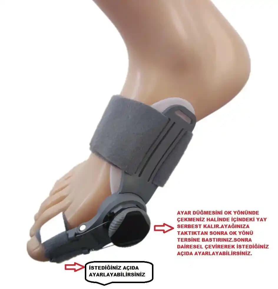 Ayak Konforunu Artıran Kemik Çıkıntısı Atelleri: Doğru Seçim ve Kullanım Rehberi