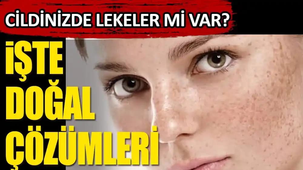 Cilt Lekeleri İçin Doğal ve Güvenilir Yöntemler Hakkında Kapsamlı Bilgi