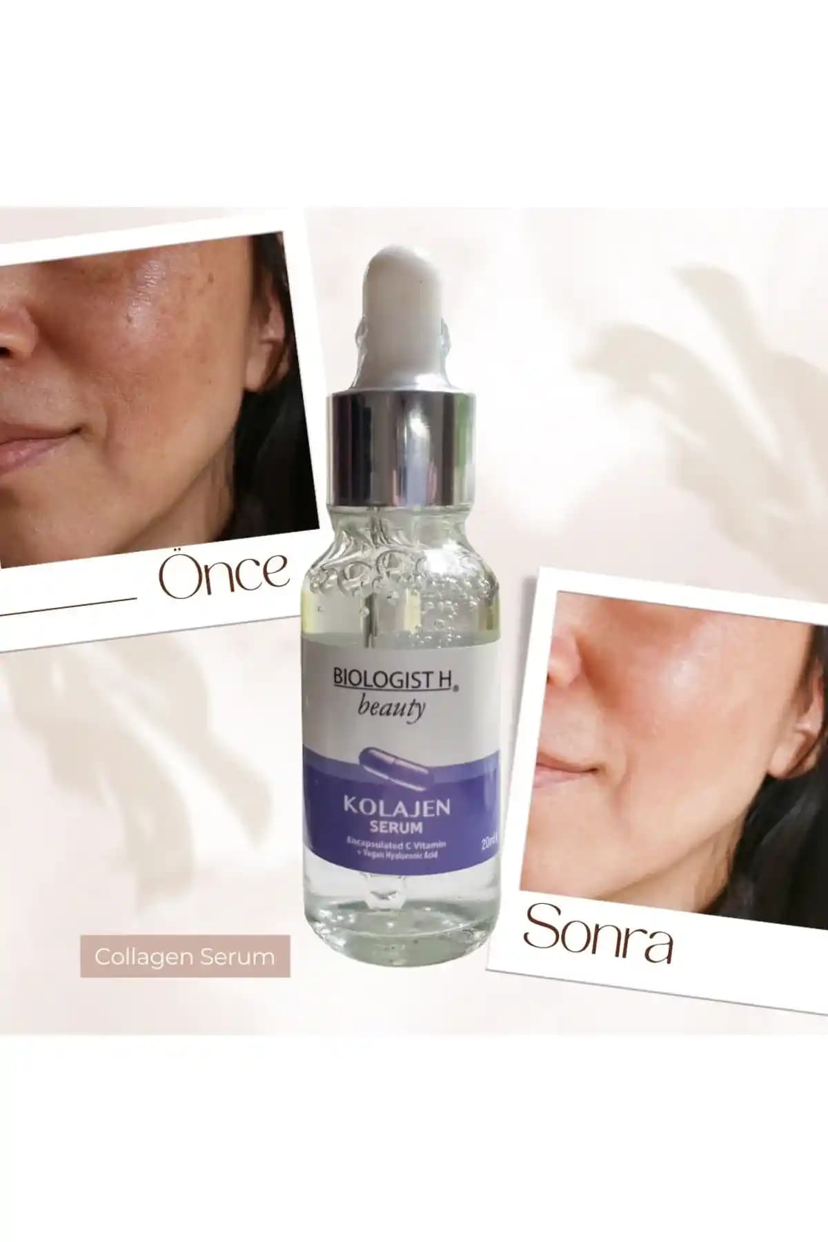 Cilt Sağlığını Destekleyen Kolajen ve Hyaluronik Asidin Önemi ve Kullanım Alanları