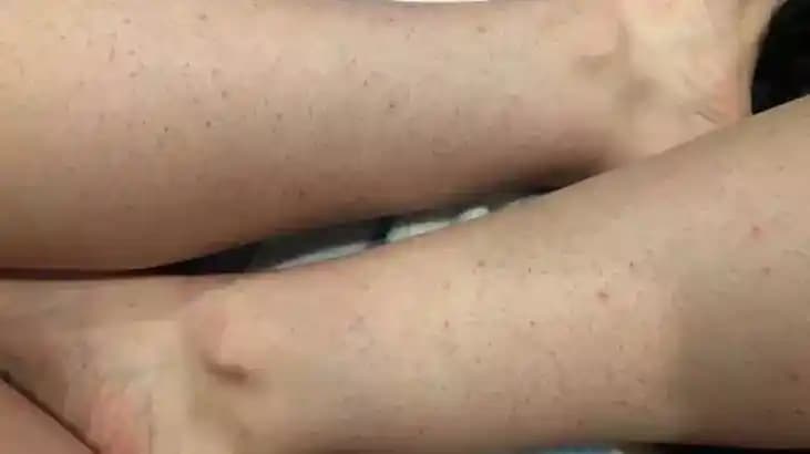 Cilt ve Bacak Görünümünü İyileştiren Güncel Bakım Yöntemleri ve Teknolojiler