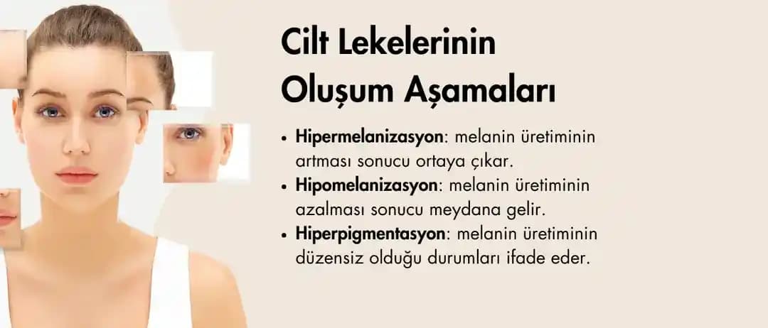 Ciltte Alerjiyi Önleme Yöntemleri ve Günlük Hayatta Dikkat Edilmesi Gerekenler