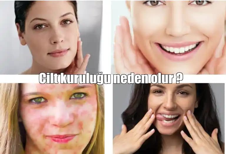 Ciltte Kuruluk Nedenleri, Belirtileri ve Etkili Bakım Yöntemleri