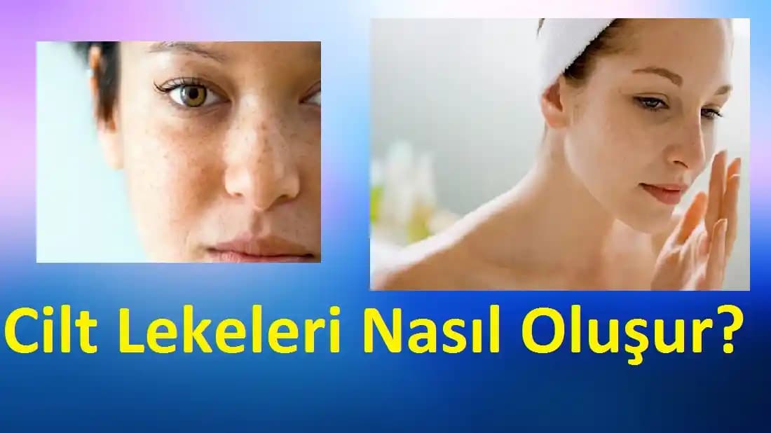 Ciltteki Lekeleri Hafifletmek İçin Etkili Yöntemler ve Doğru Uygulama İpuçları