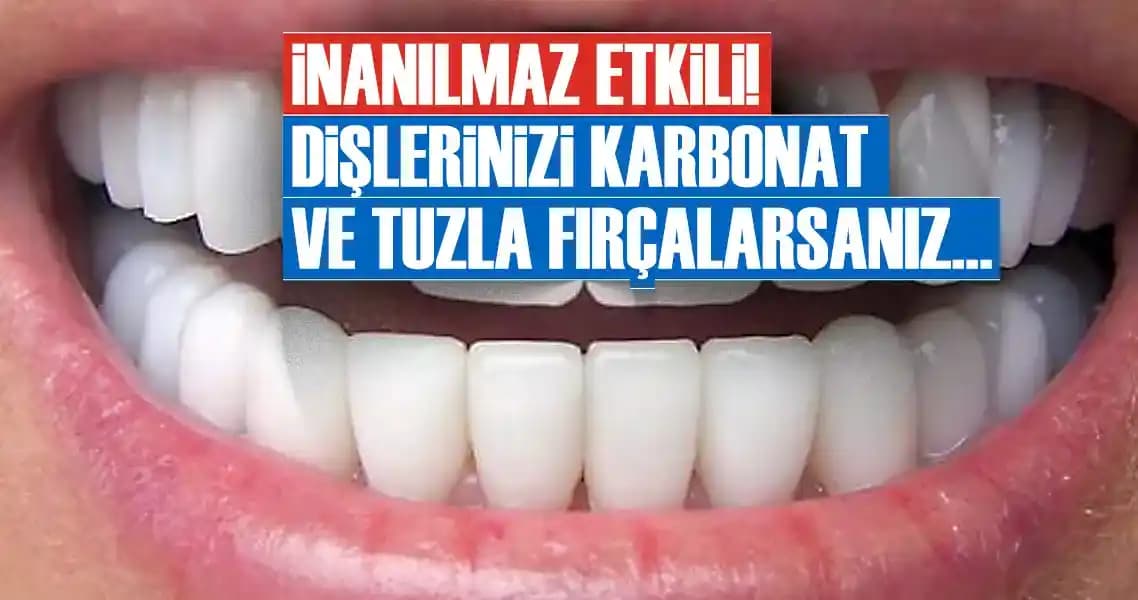 Diş Sağlığını Koruma ve Temizlik Alışkanlıklarının Önemi