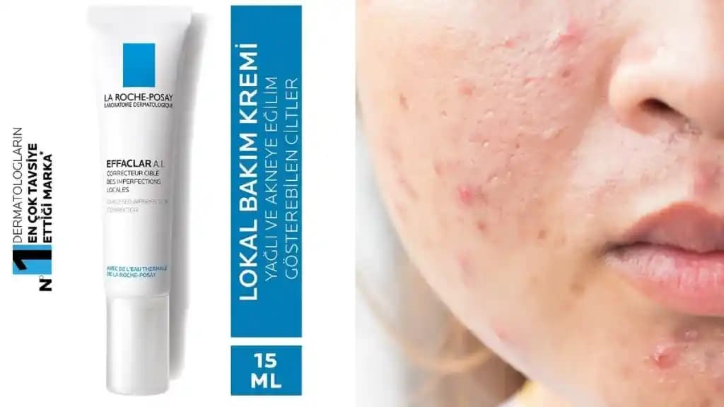 Eczaneden Temin Edilebilecek Sivilce Kremleri ve Doğru Seçim Rehberi