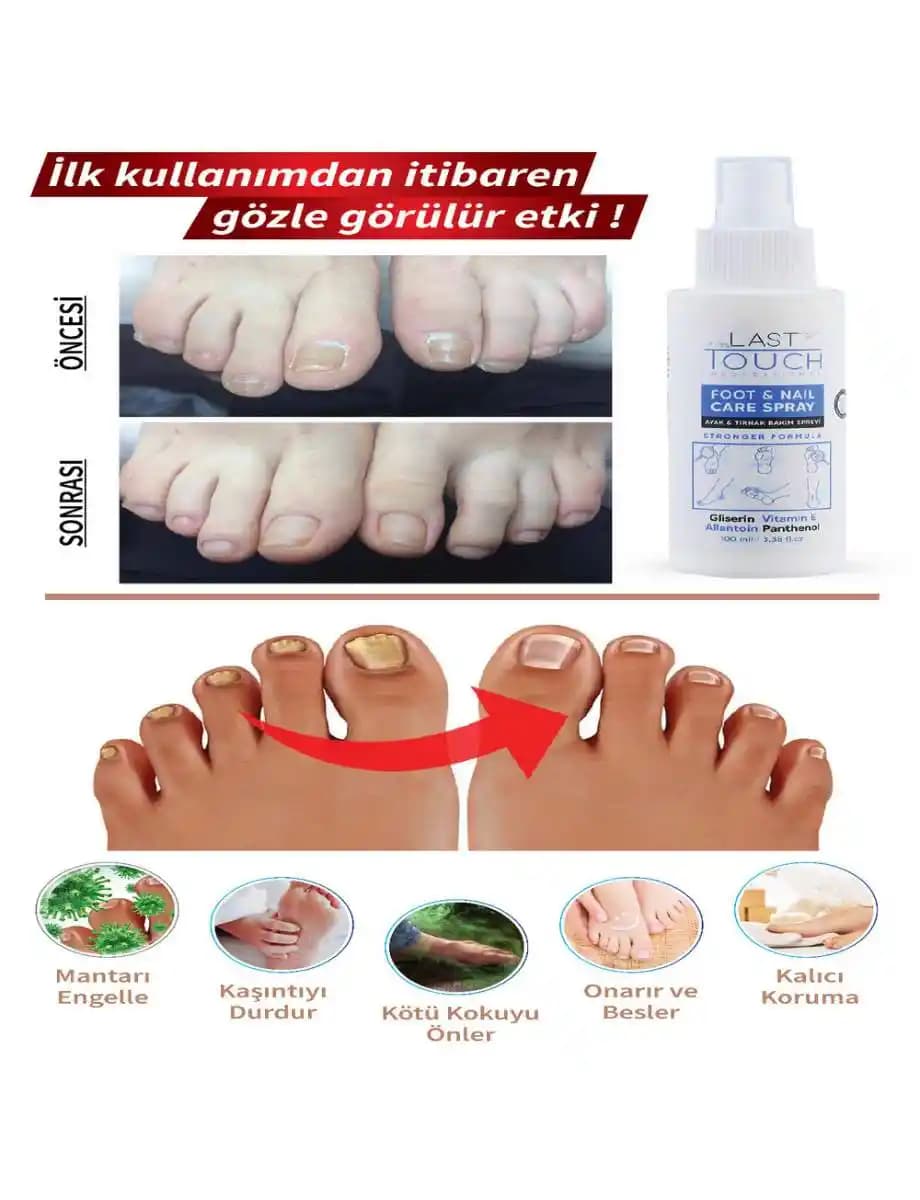 Eczaneden Temin Edilen Tırnak Mantarı Ürünleri: Güvenli ve Etkili Tedavi Seçenekleri