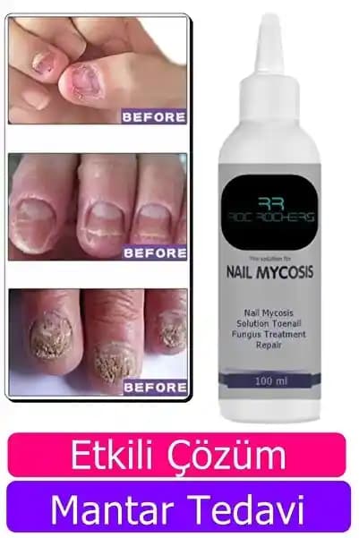 El Tırnak Bakımında Güncel Yaklaşımlar ve Uygulama İpuçları