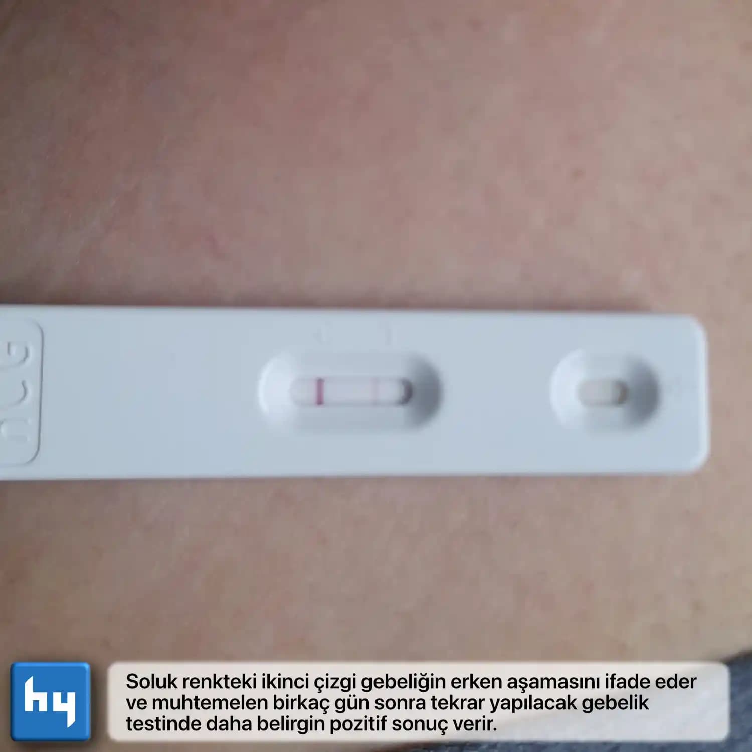 Gebelik Testi Sonuçlarının Doğru Yorumlanması ve Sağlık Üzerindeki Önemi